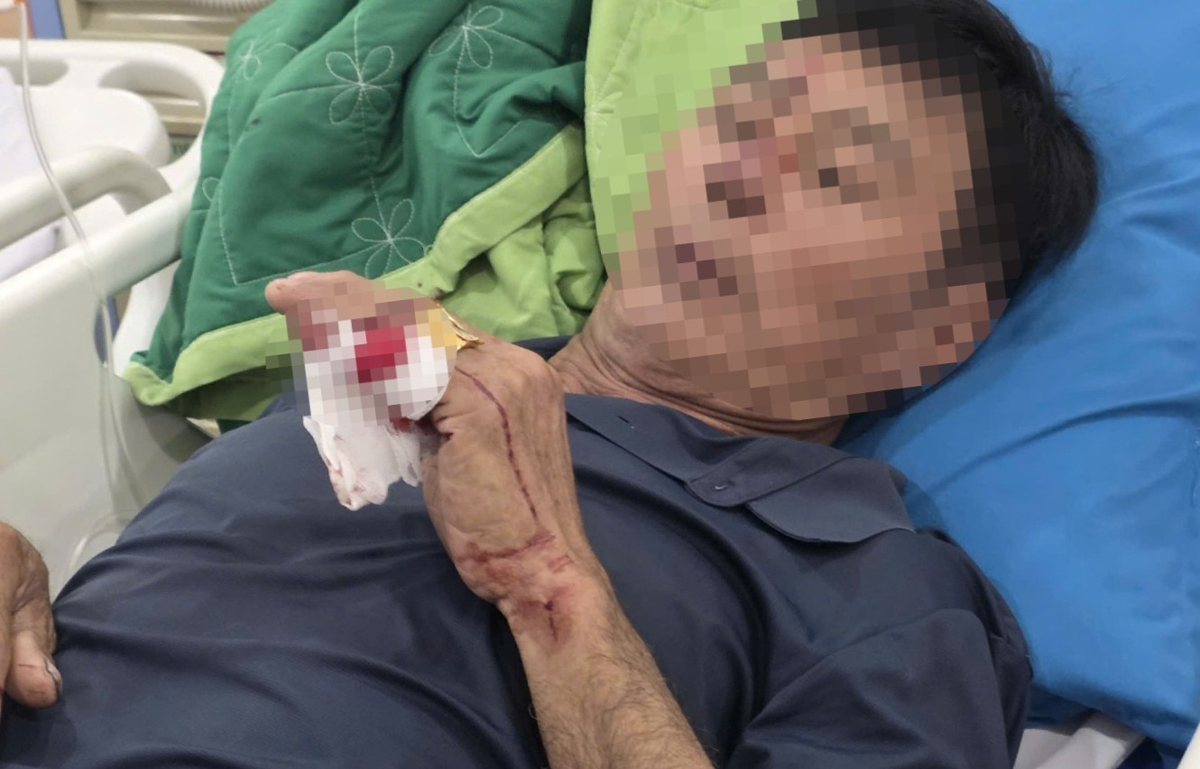 Vụ sà lan tông cầu Ghềnh: Một nạn nhân phải phẫu thuật