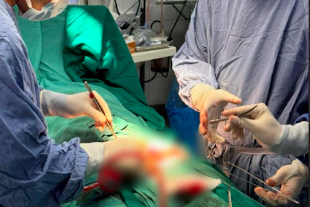 Vi phẫu trong ‘giờ vàng’, cứu người đàn ông tự cắt bộ phận sinh dục