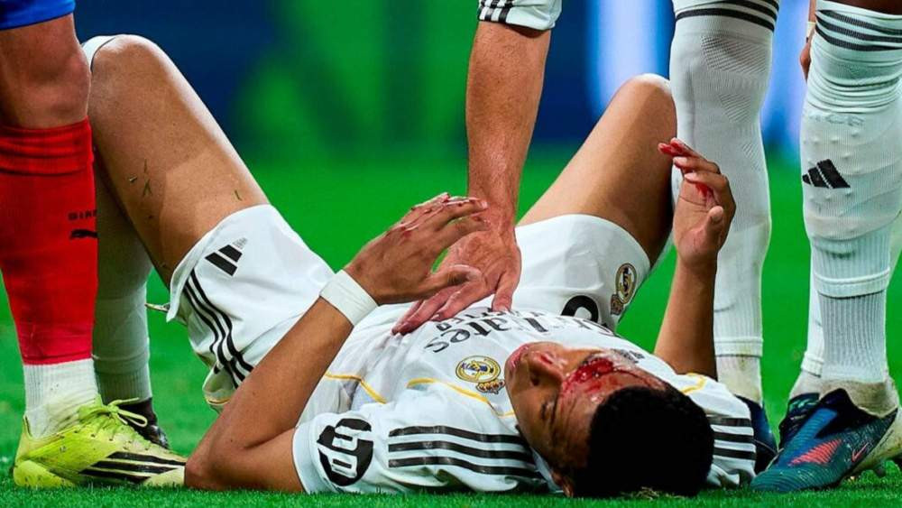 mbappe defensa 5.jpeg