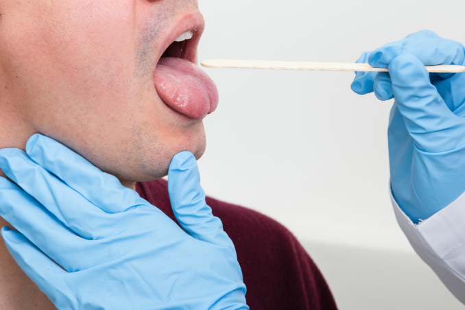 3 dấu hiệu hệ tiêu hóa 'ốm yếu' bộc lộ trên lưỡi