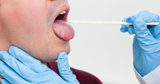 3 dấu hiệu hệ tiêu hóa "ốm yếu" bộc lộ trên lưỡi