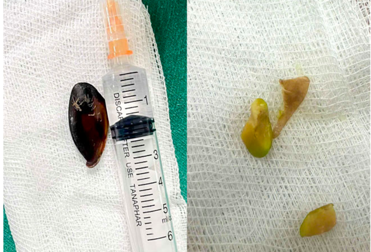 Ảnh chụp Màn hình 2026 04 13 lúc 20.05.58.png