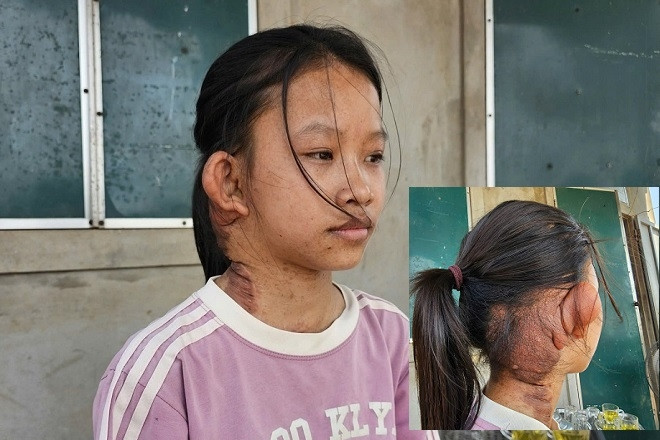 Ông bà nghèo kiệt quệ trước ca mổ lần 3 của cháu ngoại: 'Không biết vay ở đâu'