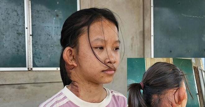 Ông Bà Nghèo Kiệt Quê Trước Ca Mổ Lần 3 Của Cháu Ngoại, Không Biết Vay Ở Đâu
