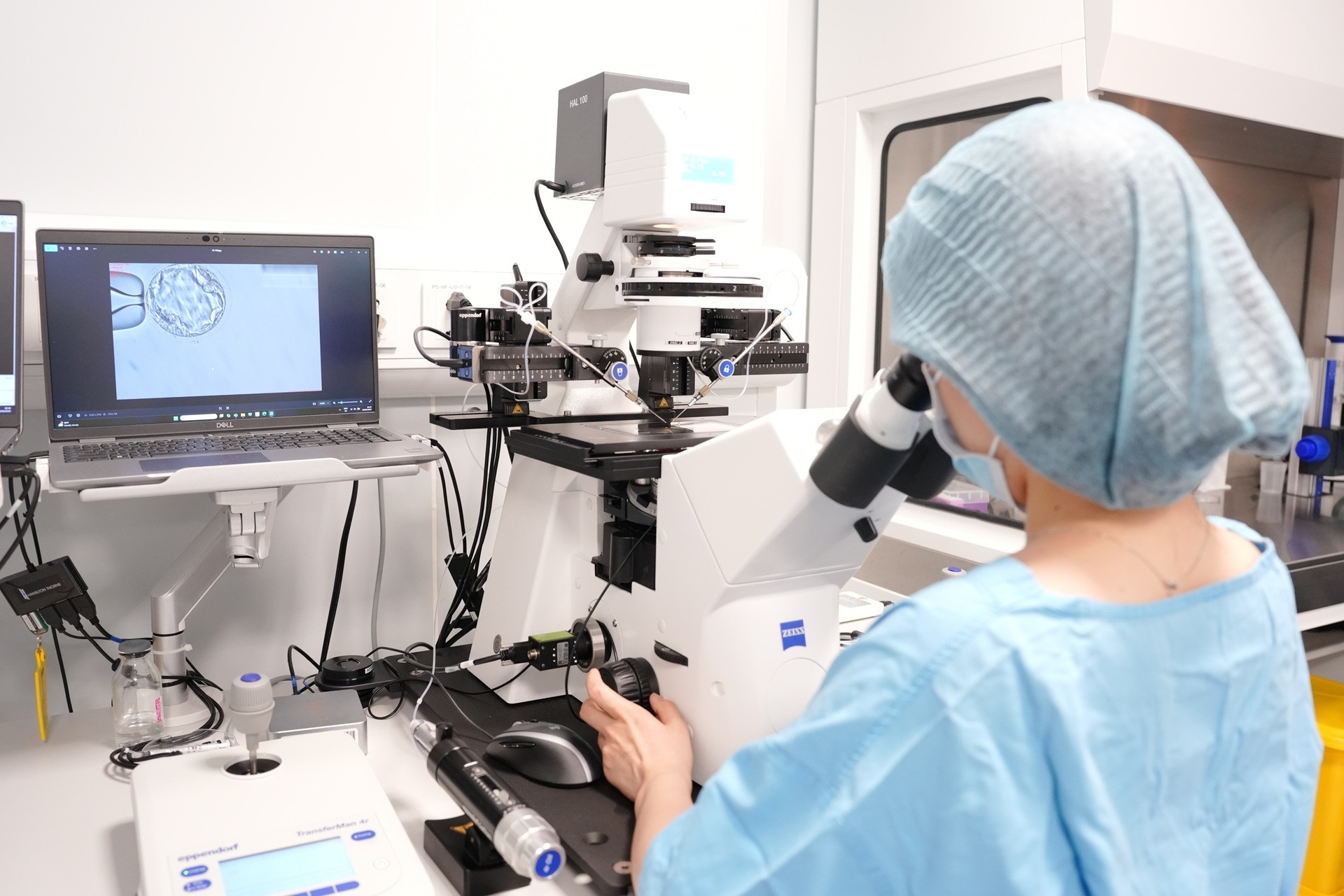 Piezo ICSI - Công nghệ tạo phôi mới, thêm cơ hội cho các ca IVF khó