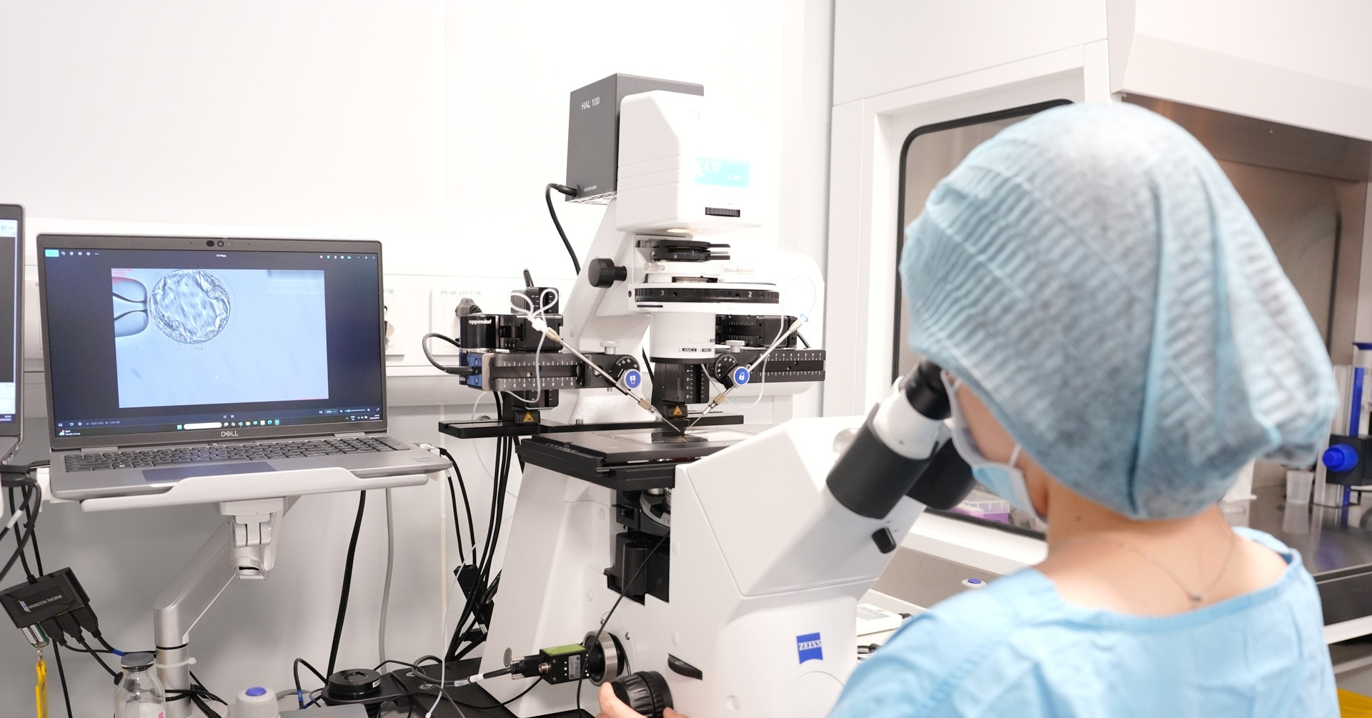 Piezo ICSI - Công nghệ tạo phôi mới, thêm cơ hội cho các ca IVF khó