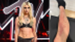 taylor momsen spider bite.webp