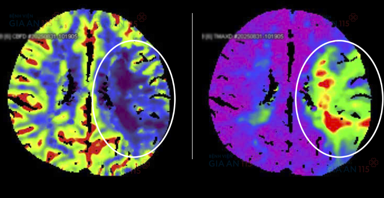 0000ket qua chup.png