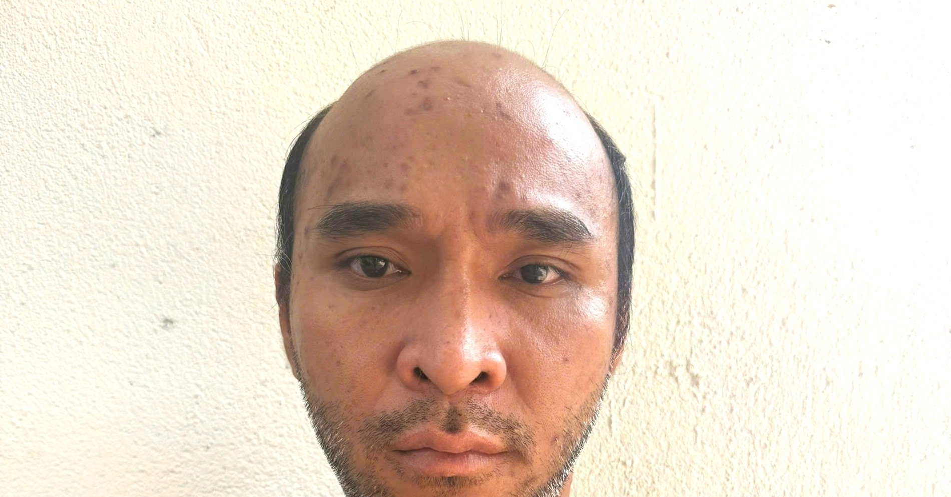 Ca sĩ lô tô bị bắt vì giật điện thoại du khách nước ngoài