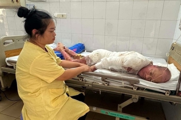 Chồng tâm thần bị bỏng nặng, vợ nghèo bán sạch tài sản không lo đủ viện phí