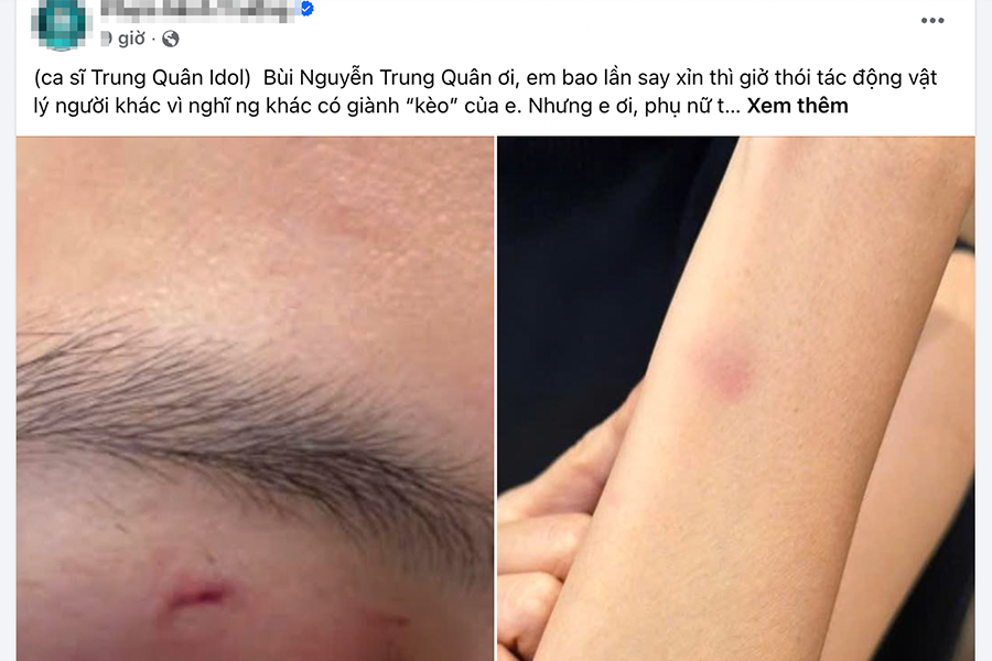 Công an xác minh thông tin ca sĩ Trung Quân Idol bị tố hành hung nữ bác sĩ