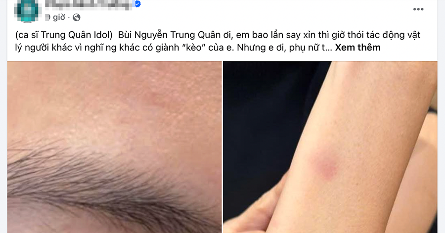Công an xác minh thông tin ca sĩ Trung Quân Idol bị tố hành hung nữ bác sĩ