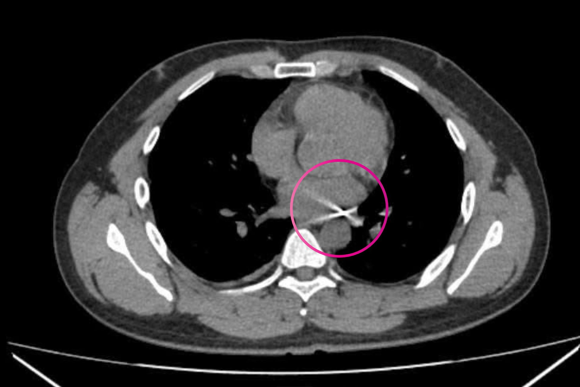 Thiết kế chưa có tên.jpg
