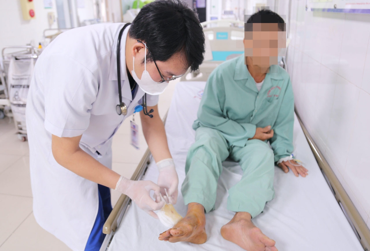 Tiêm 30 lọ huyết thanh cứu chủ trang trại nuôi hàng nghìn con rắn