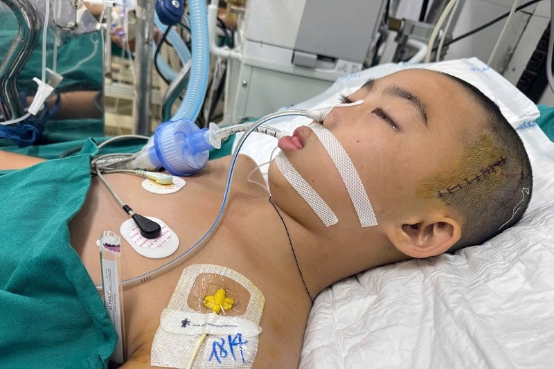 Bé trai 13 tuổi người Tày ngã nguy kịch, rất cần cộng đồng tiếp sức
