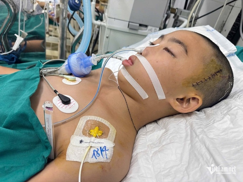 W-c8828fef e03d 4bda a0ed 750d2e5eafe0.jpg