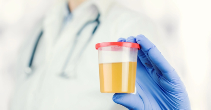 Lan truyền nguy hiểm dùng nước tiểu chữa bệnh, bác sĩ sửng sốt, cảnh báo nóng