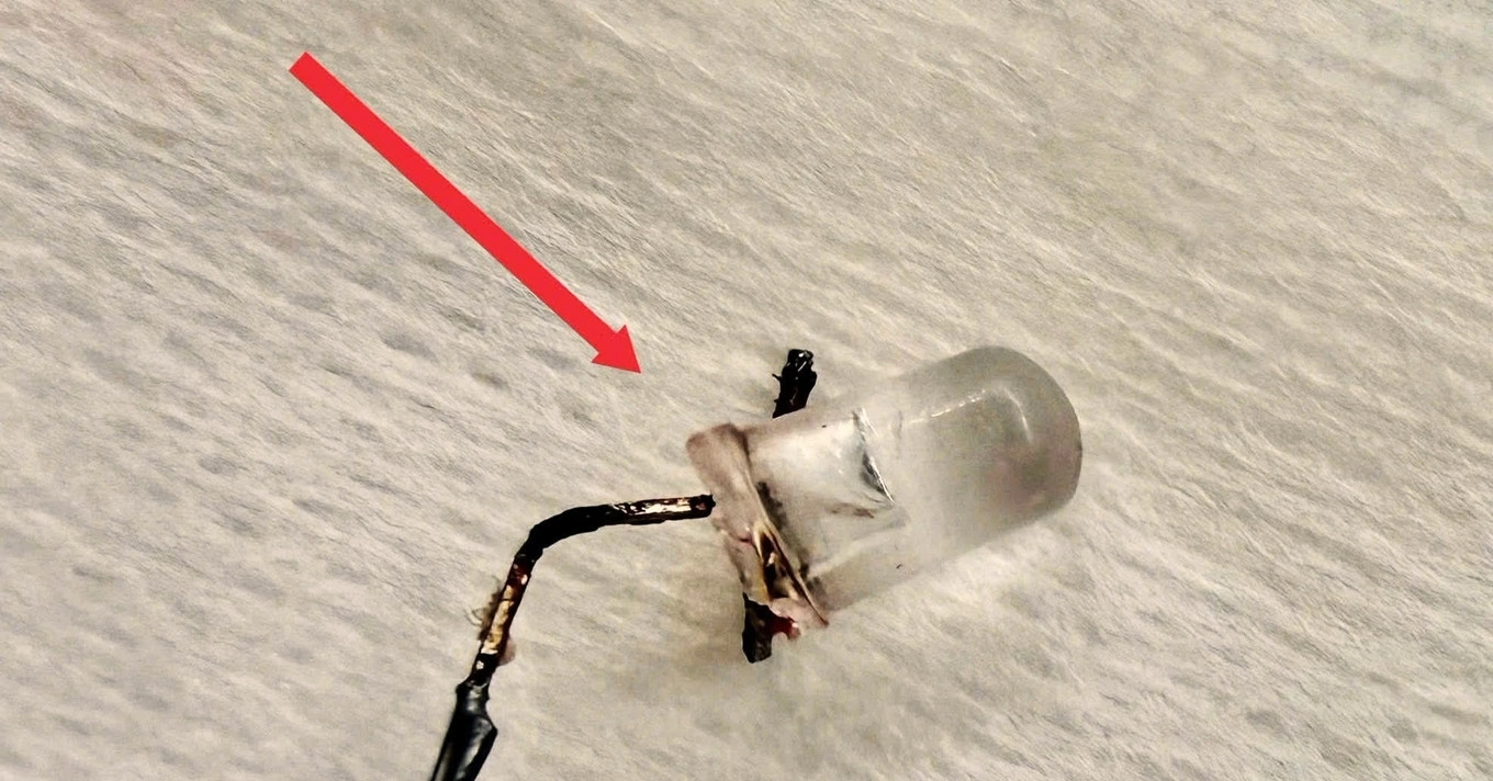 Gắp bóng đèn LED trong phổi bé 9 tháng tuổi