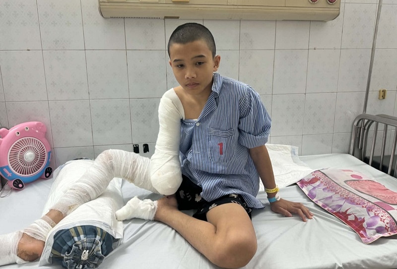 Tai nạn điện cao thế cướp 1/3 cánh tay phải, tương lai cậu bé 16 tuổi chênh vênh