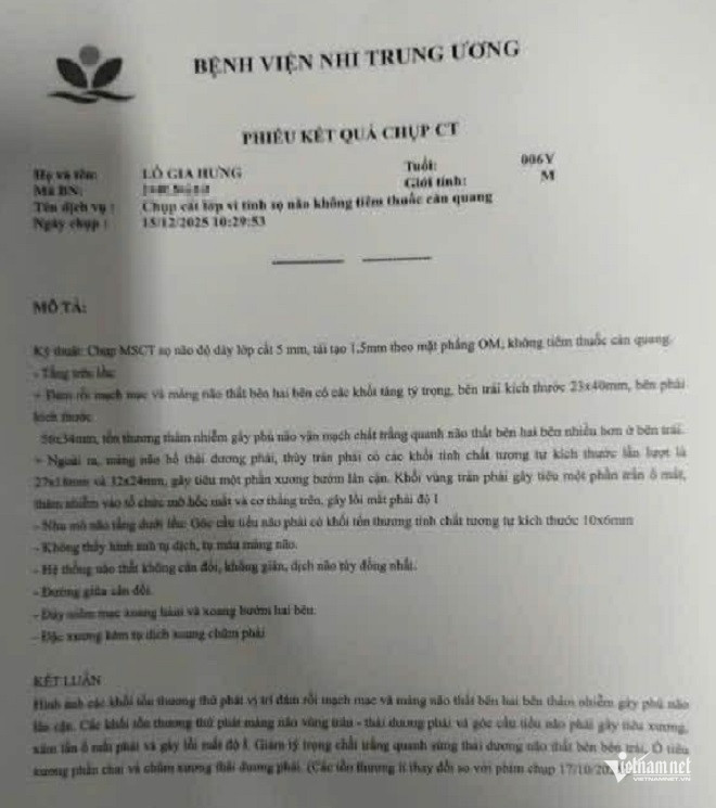 W-bệnh án bé hưng.jpg