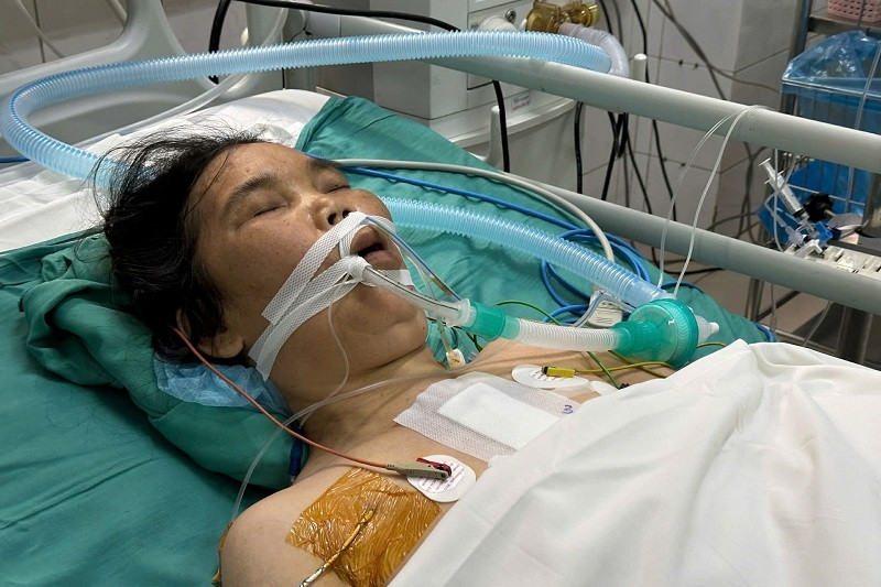 Người phụ nữ suy tim 15 năm nguy kịch, gia đình thiếu gần 200 triệu cứu chữa