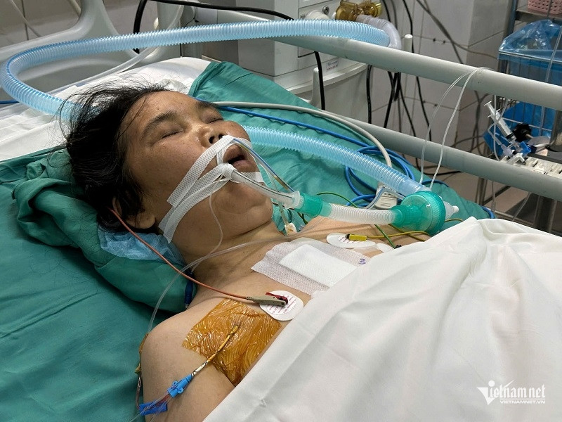 W-cc5eb701 8b4e 4e03 9825 79bca64b7a97.jpg