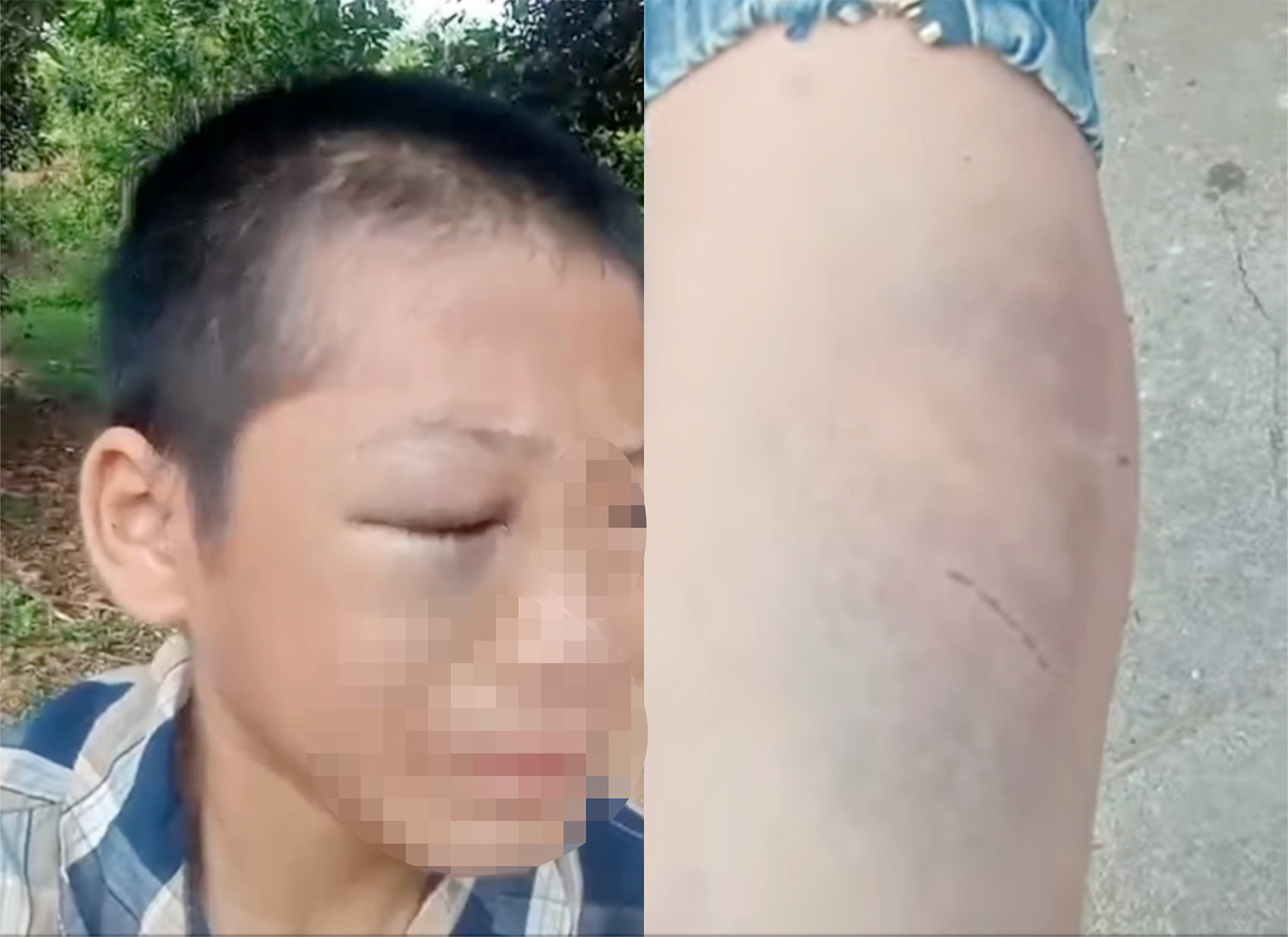 bé trai nghi bị bạo hành.jpg