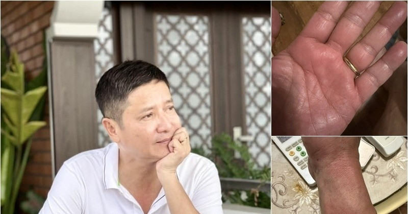 Căn bệnh NSƯT Chí Trung phải chung sống khổ sở suốt nửa năm có thật sự lạ?