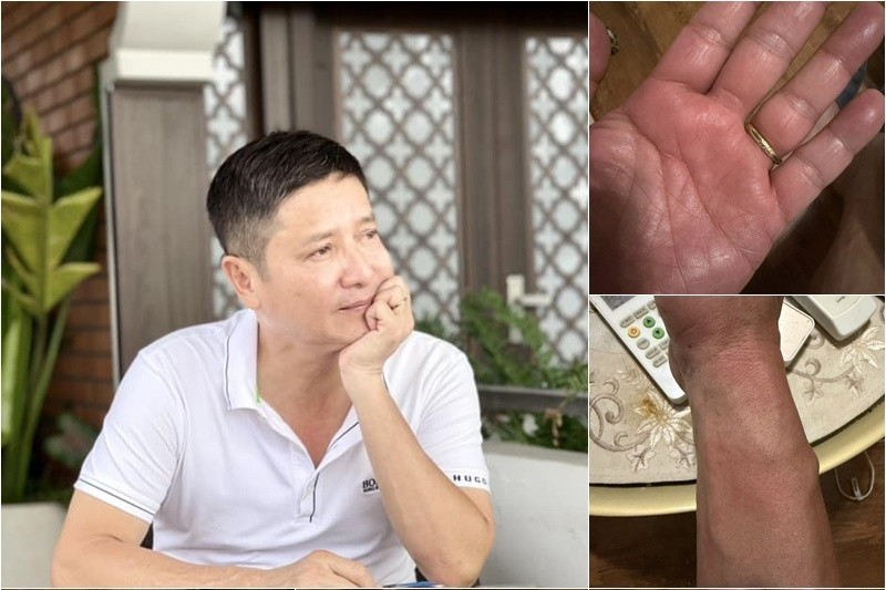 NSƯT Chí Trung mắc bệnh lạ, mất ngủ triền miên