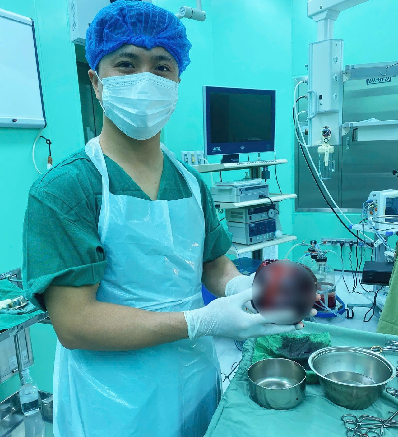 Chủ quan đau bụng nhẹ, người đàn ông suýt mất mạng vì khối u bằng quả dưa lưới.jpg