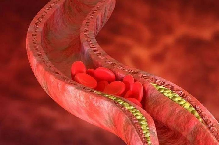 Nữ công nhân chế biến hải sản suýt phải cắt cụt chân vì đứng lâu