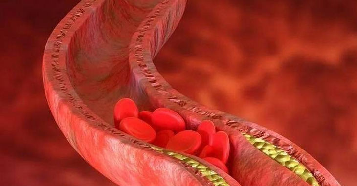 Nữ công nhân chế biến hải sản suýt phải cắt cụt chân vì đứng lâu