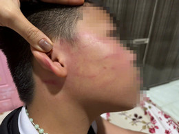 Nam sinh bị thầy đánh.jpg