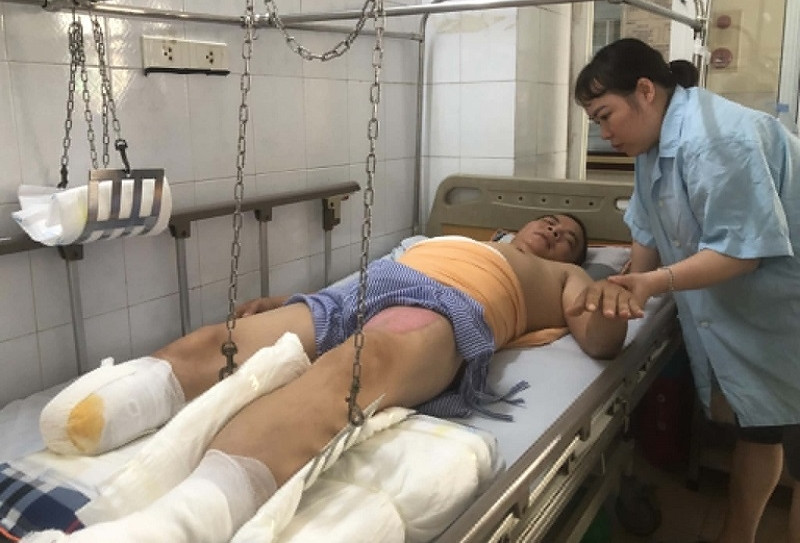 Chồng bị tàn phế do bỏng điện cao thế, nợ nần bủa vây người vợ nghèo