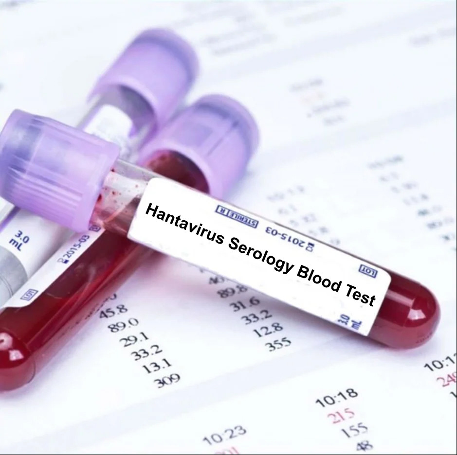 hantavirus.jpg