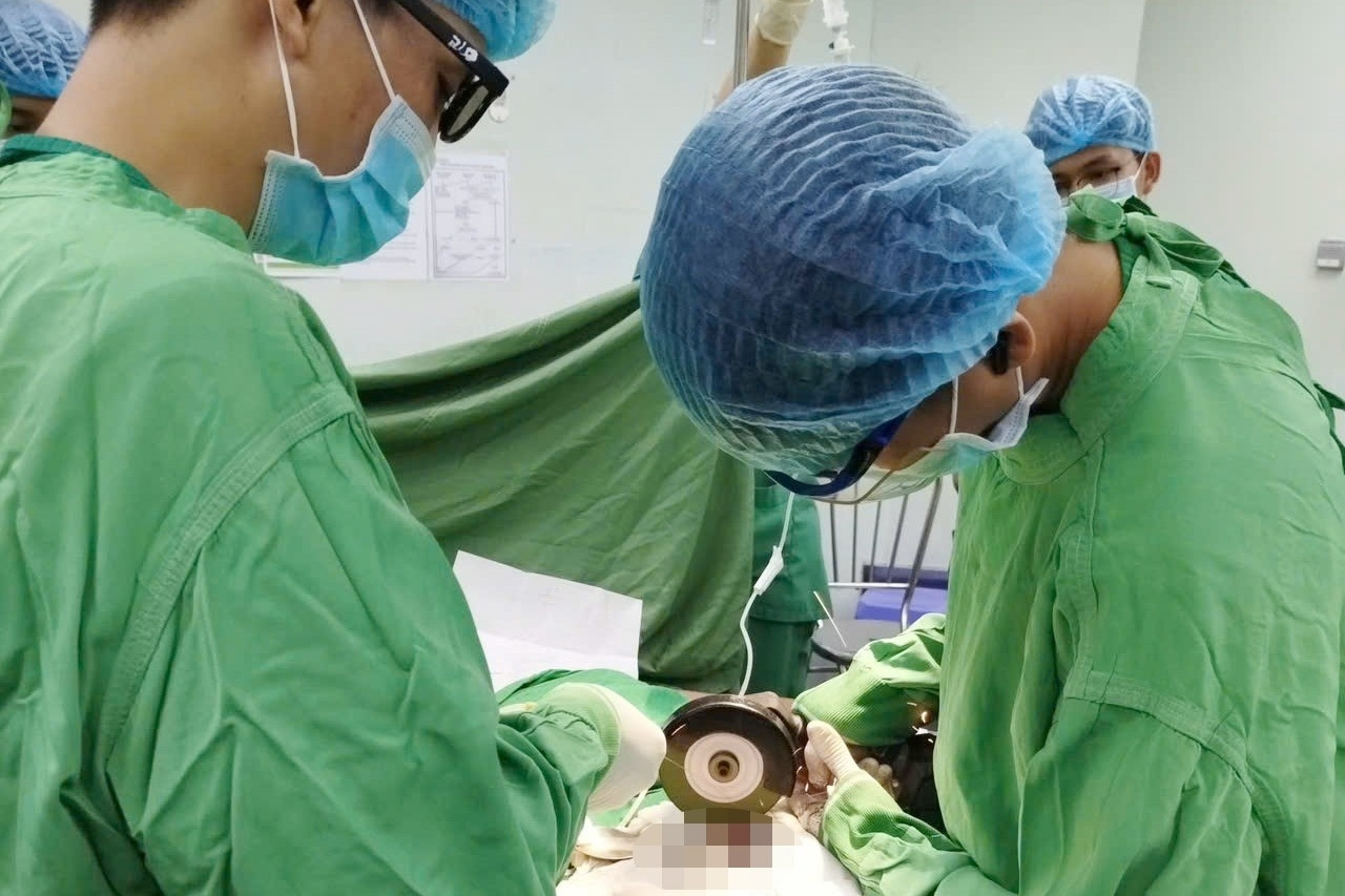 Ca cấp cứu hy hữu, bác sĩ dùng máy cắt tháo bỏ đai ốc siết vùng nhạy cảm bệnh nhân