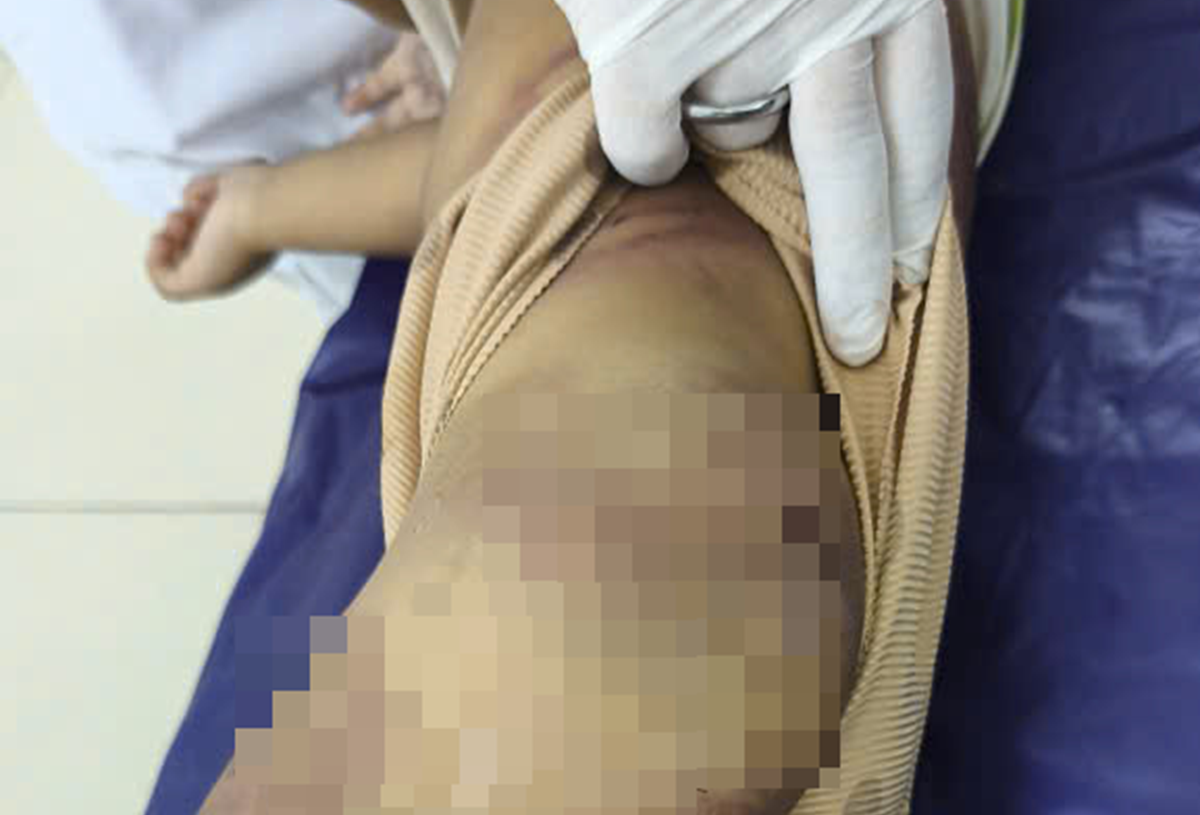 Vụ bé trai 2 tuổi bị mẹ ruột và cha dượng bạo hành: Người thân từ chối chăm sóc