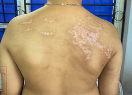 Thương tích của cháu Nguyễn Đình Bảo Khánh 4__2e7d636e8e.jpg