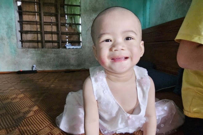 Thông tin mới về bé gái gần 2 tuổi sống cùng mẹ và cậu mắc bệnh tâm thần