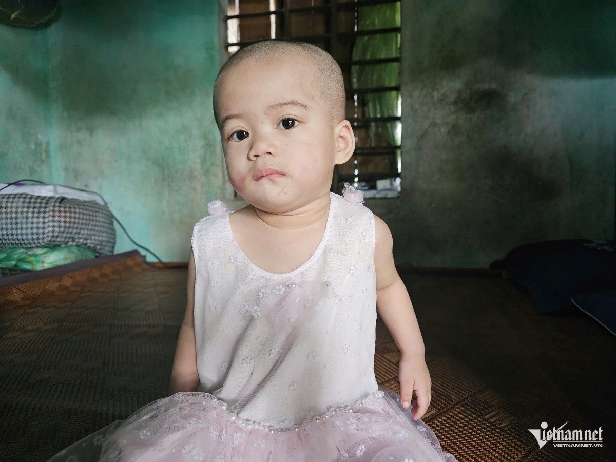 W-anh 1.jpg