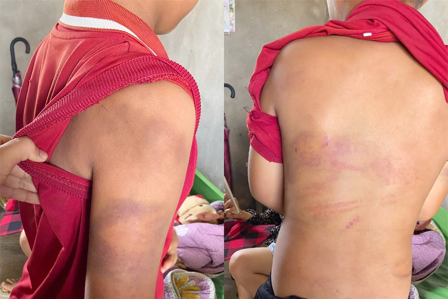 Con trai 10 tuổi bị bạo hành, mẹ gấp rút bay về nước giành quyền nuôi dưỡng