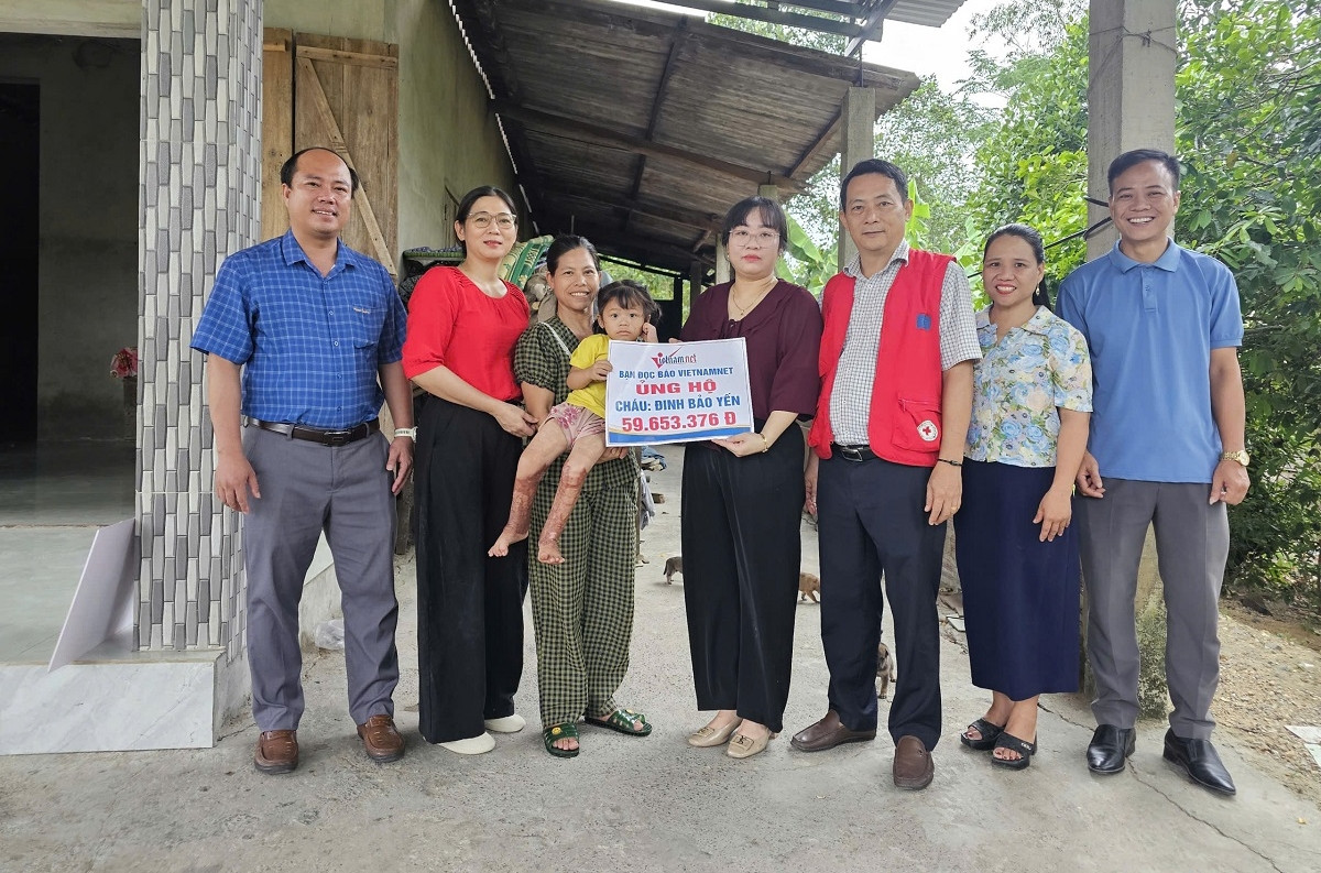 Trao hơn 59 triệu đồng đến cháu bé trải qua 12 ca phẫu thuật sau vụ bỏng xăng