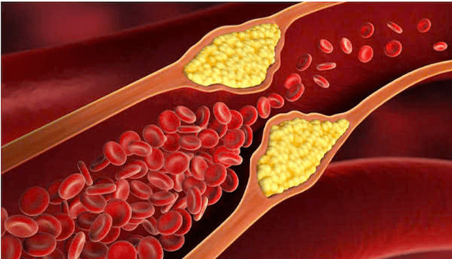 Cholesterol trong mau.jpg