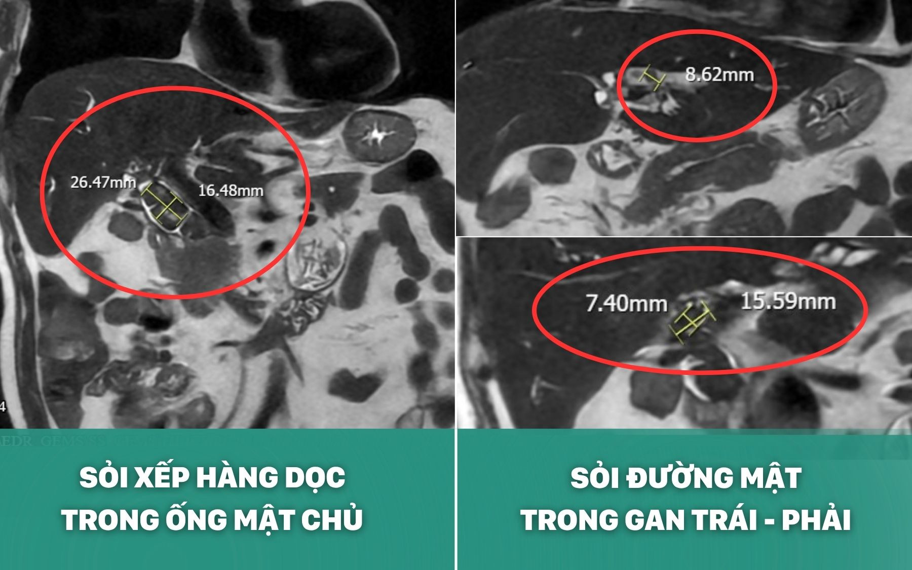Anh 1.jpg