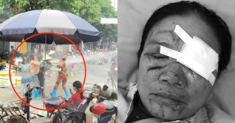 Liên tiếp xảy ra vụ xịt vòi nước cao áp vào người khác, luật sư nói gì?