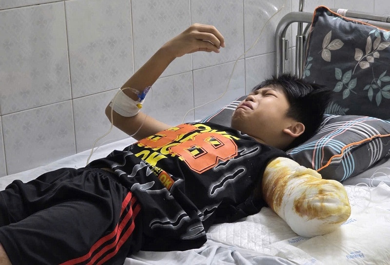 Tiếng kêu đau đớn của cậu bé 11 tuổi bị bỏng điện: 'Mẹ ơi, tay con đâu rồi?'