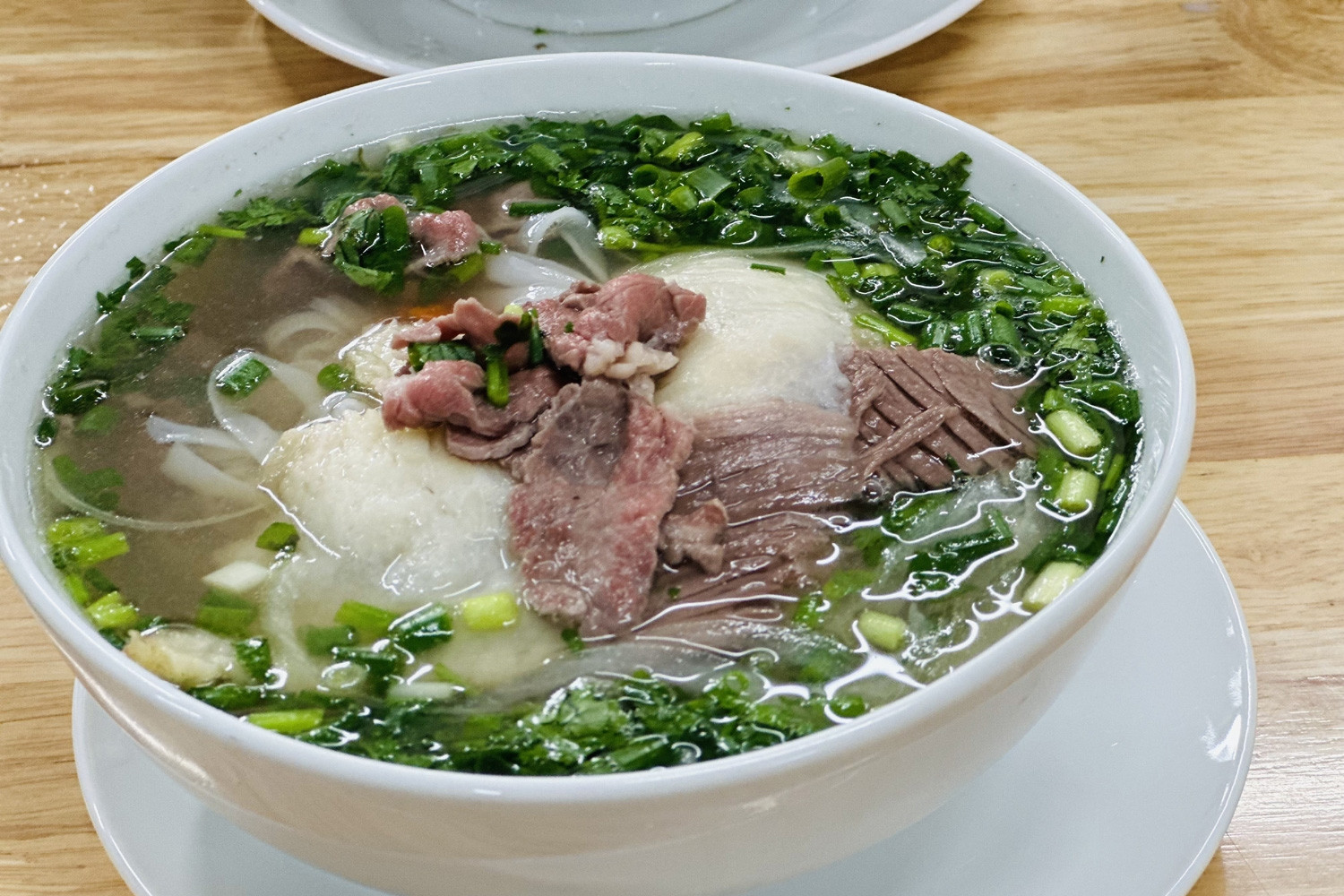 Người đàn ông suýt mất mạng vì 1 thói quen ăn sáng kéo dài nhiều năm