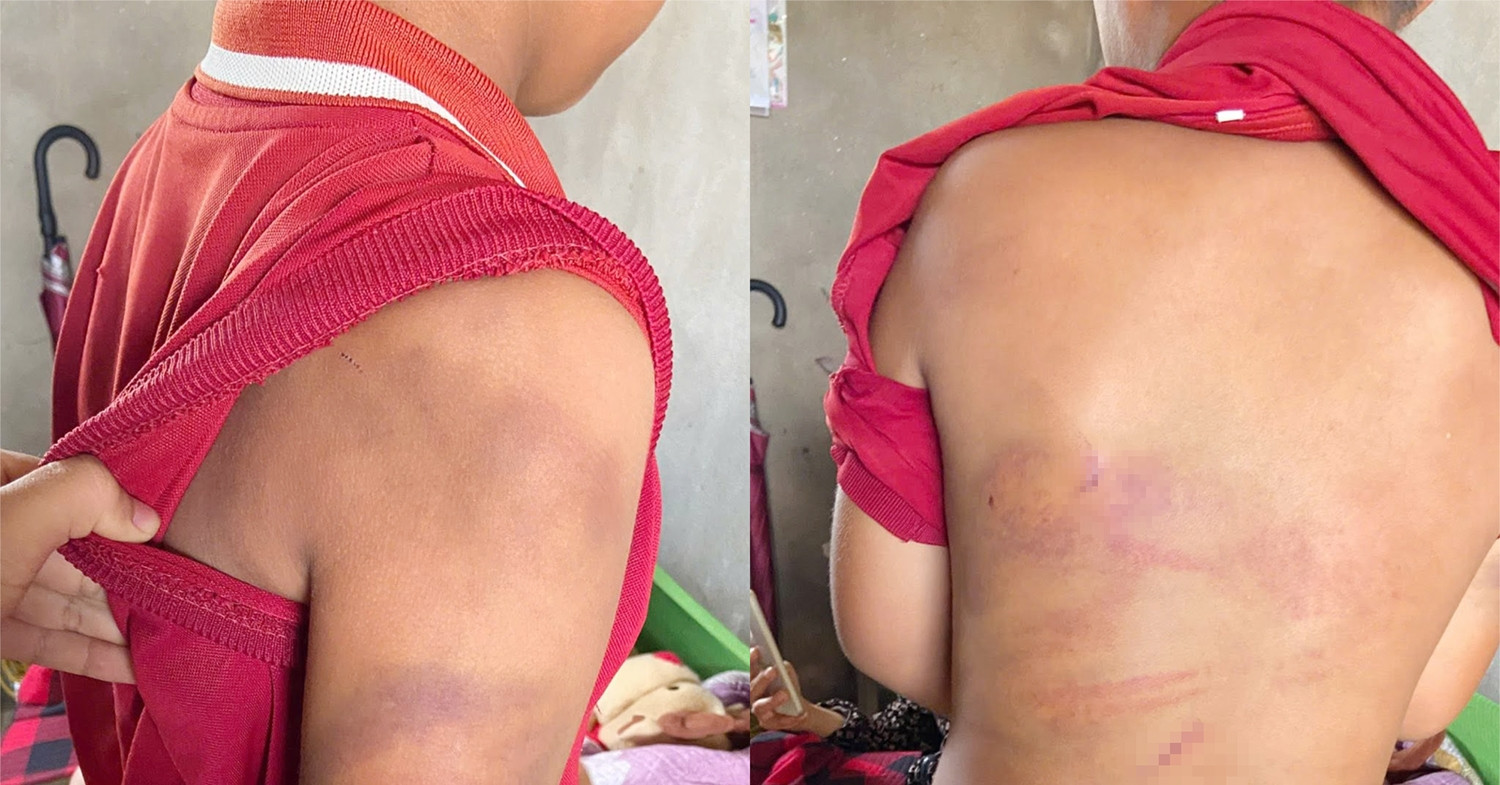 Đến thăm cháu trai, bà ngoại phát hiện chuyện đau lòng, vội trình báo công an