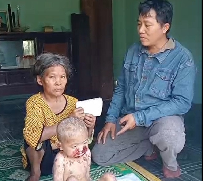 bé hùng bệnh lạ.jpg