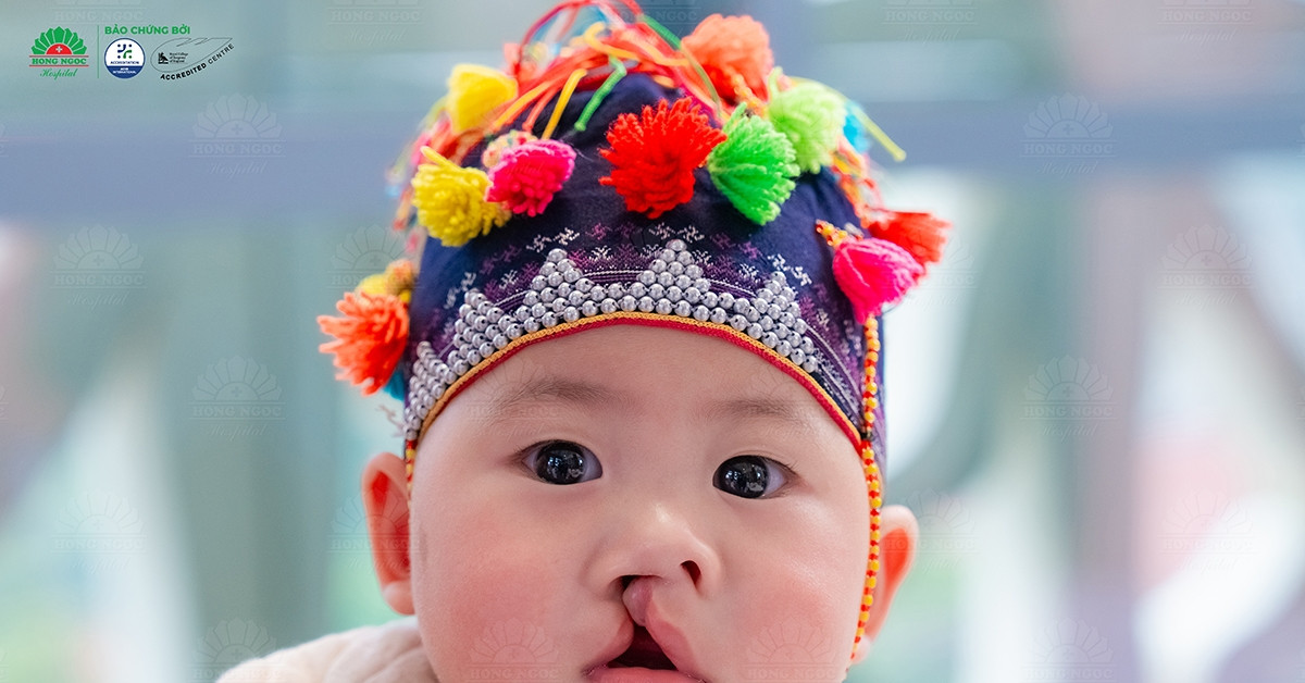 Bệnh viện Hồng Ngọc phẫu thuật miễn phí cho trẻ mắc dị tật hở môi - vòm miệng